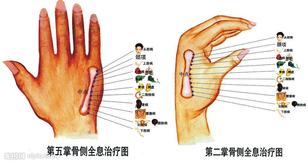 运用第二掌骨诊病知识