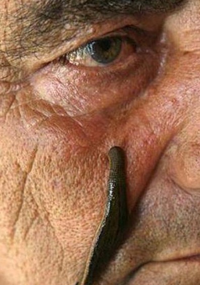 28种世界各国治病怪方生吞活鱼治哮喘组图