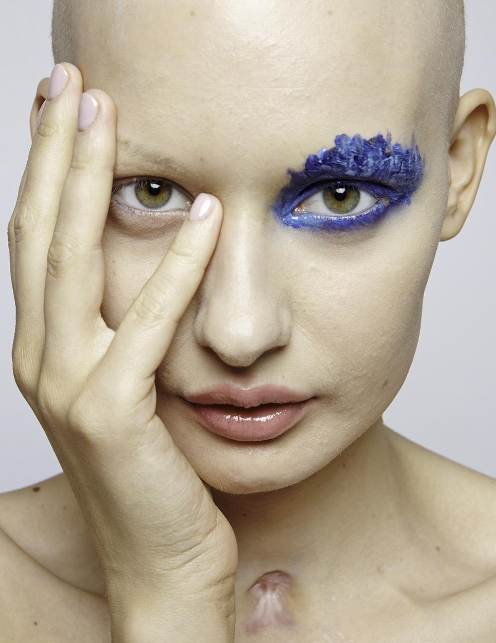 一个因癌症而失去下巴的模特和她迎接重生的非凡旅程