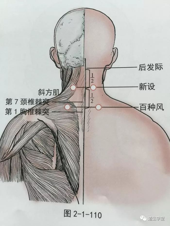 脖子刮痧位置示意图图片