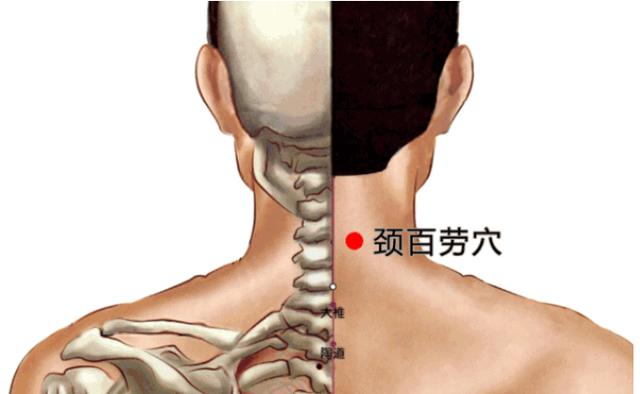 位置:位于项部,在大椎直上2寸,后正中线旁开1寸.