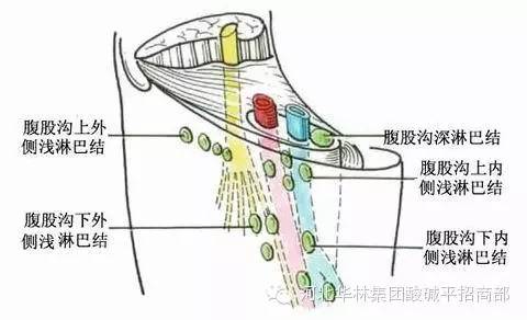 震驚淋巴淤堵不容忽視腹股溝淋巴是整個生殖系統最大的排毒系統