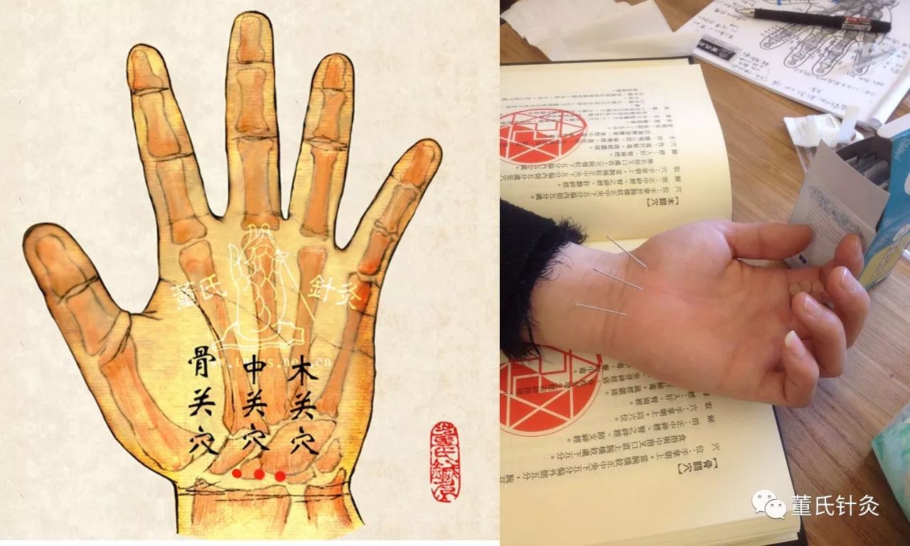 穴位位置图#【手解,腕顺,中白下白,五虎,骨关木关中关,下三皇,分枝