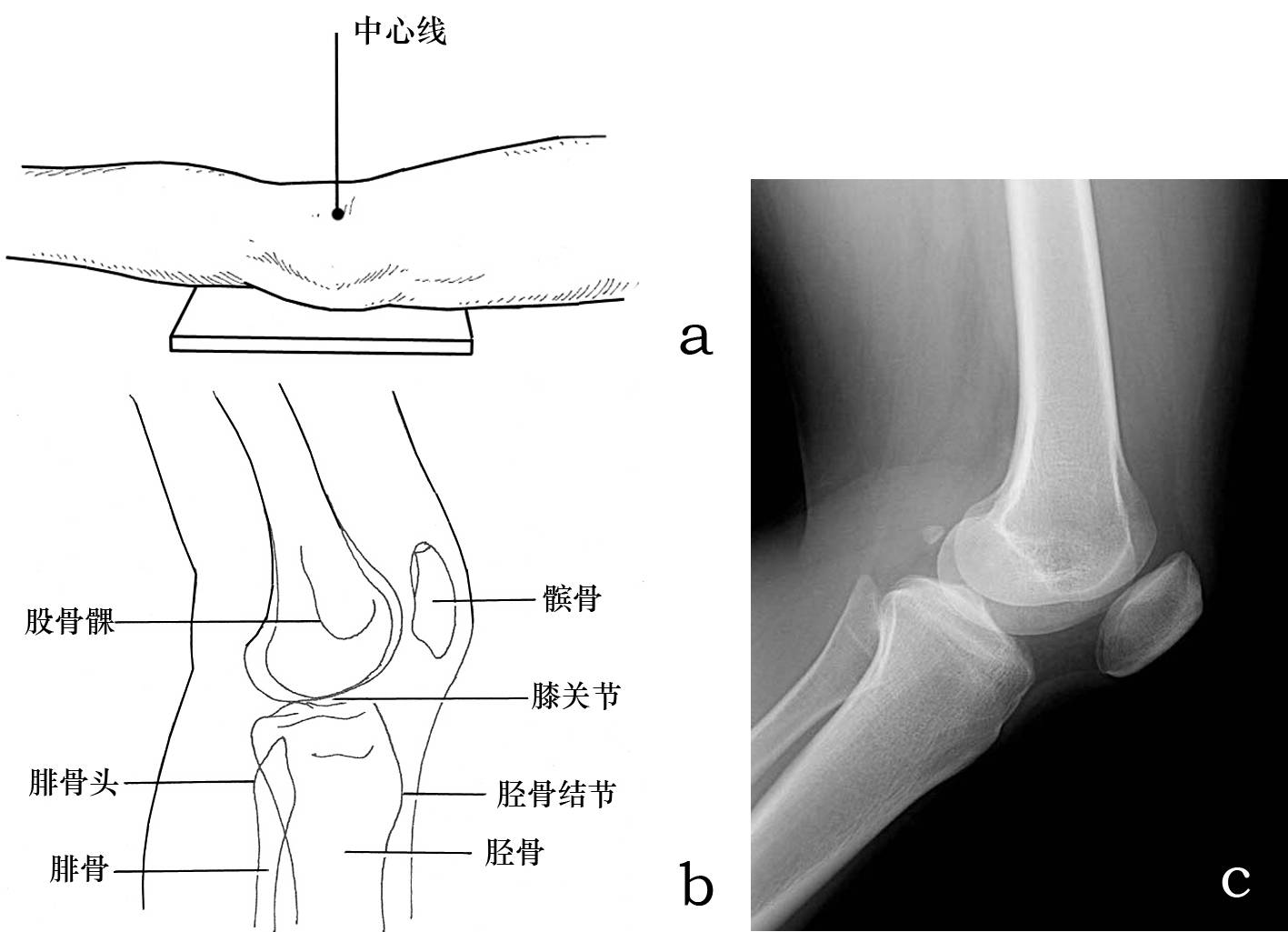 膝关节侧位解剖图片