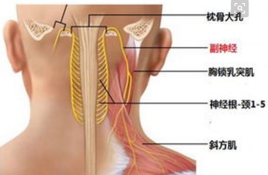 十一,副神经,颈部清扫的时候可能损伤.