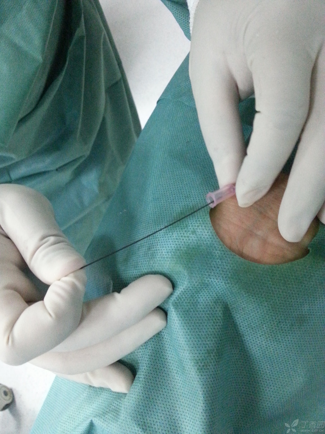 冠脉造影流程操作最详细--------新人入门全纪录