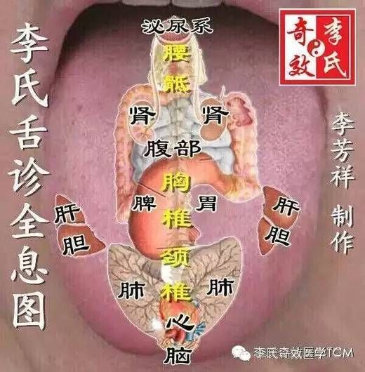 李氏舌诊用药图谱图片