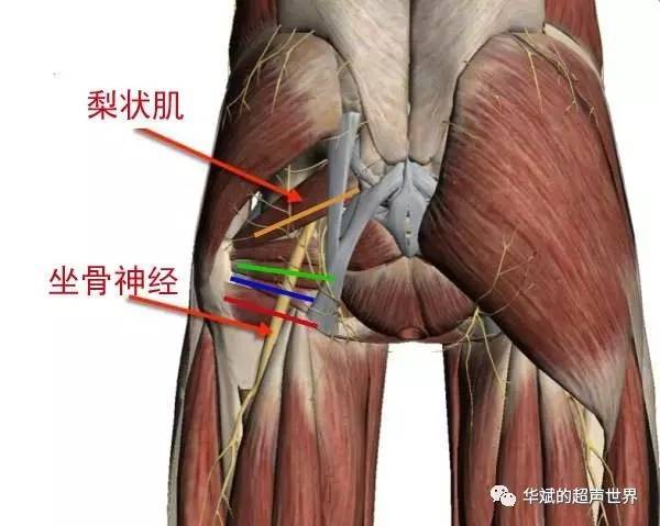 神经超声解剖:臀部坐骨神经