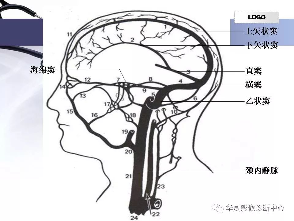 脑静脉窦血栓形成