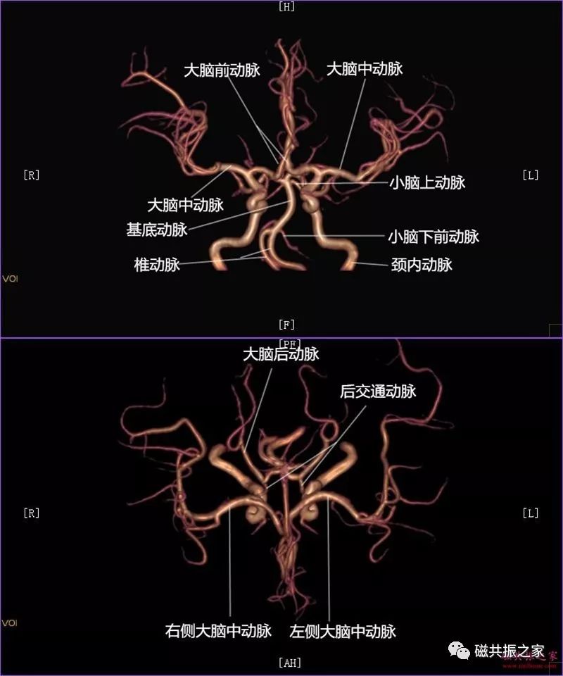 颅内mra解剖及其分段