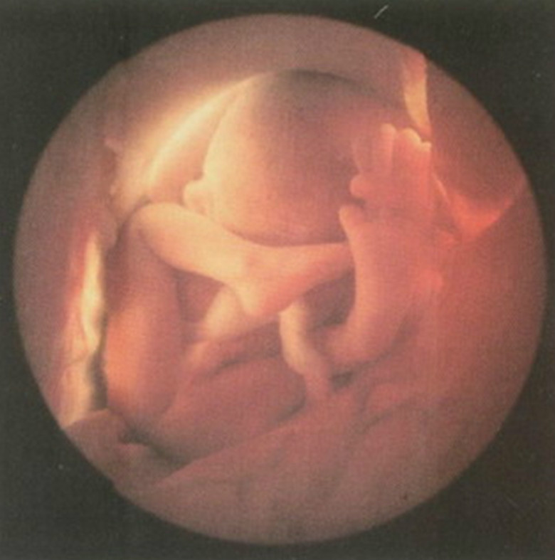 十月怀胎各时期需要补充的主要营养素