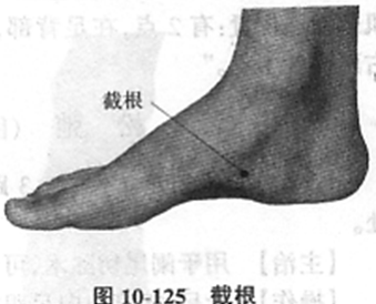 "截根"穴,从然谷下五分处施灸.