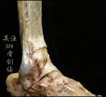 踝关节不稳定(4)-踝伸肌下支持带解剖