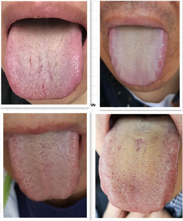 汤出自清代 · 王清任的《医林改错》,主治癫狂,哭笑不休,詈骂歌唱,不