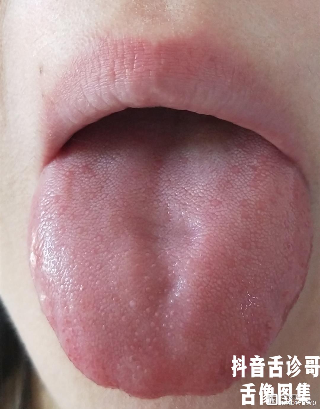 舌头中间有凹陷的图片图片