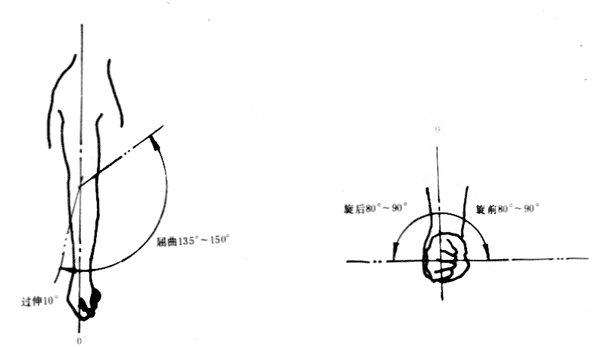 事故伤害损失工作日标准