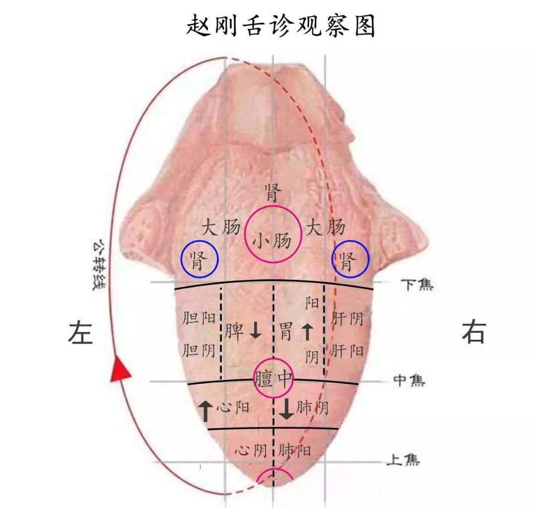 赵刚舌诊小方终点站