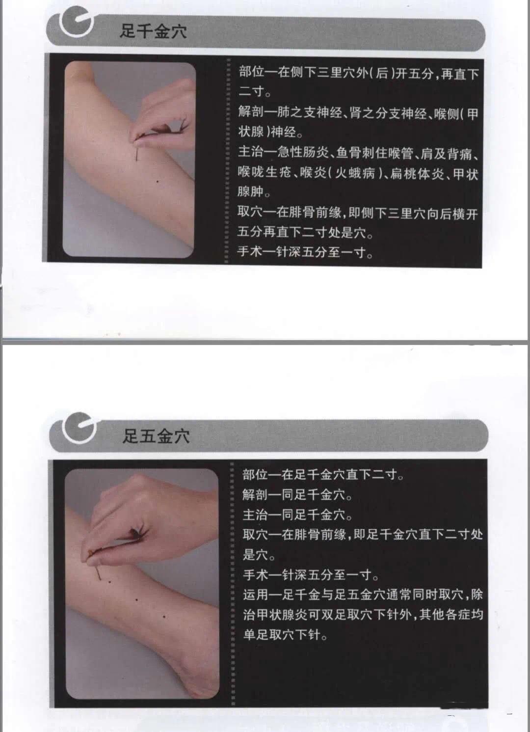 定位如图定位如图指,手,足五金,千金穴【思考与建议】:小孩流涎多因为