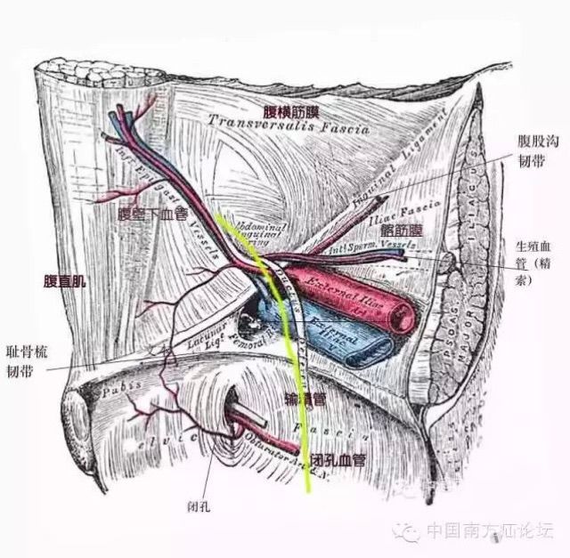 tapp相关解剖腹股沟疝腹腔镜经腹腹膜前补片修补术