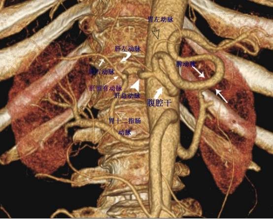 1,腹腔干ct分支↓2,主动脉重要ct分支↓腹腔干起源于腹主动脉,出现于
