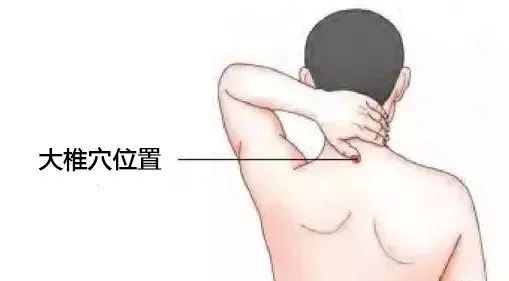 "富贵包"又称"夺命包,"一个中医手法轻松消除它