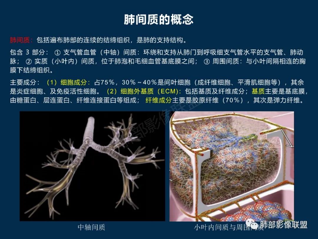 特发性间质性肺炎的病理影像特点