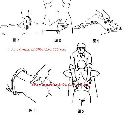 前列腺按摩顺序示意图图片