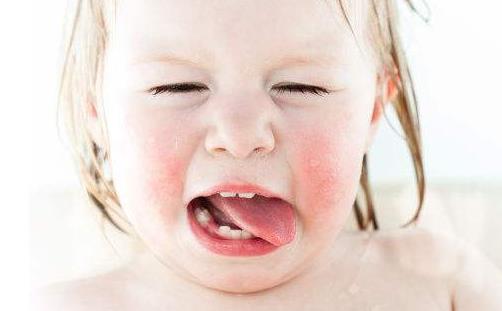 什么是蛲虫病蛲虫的症状有哪些