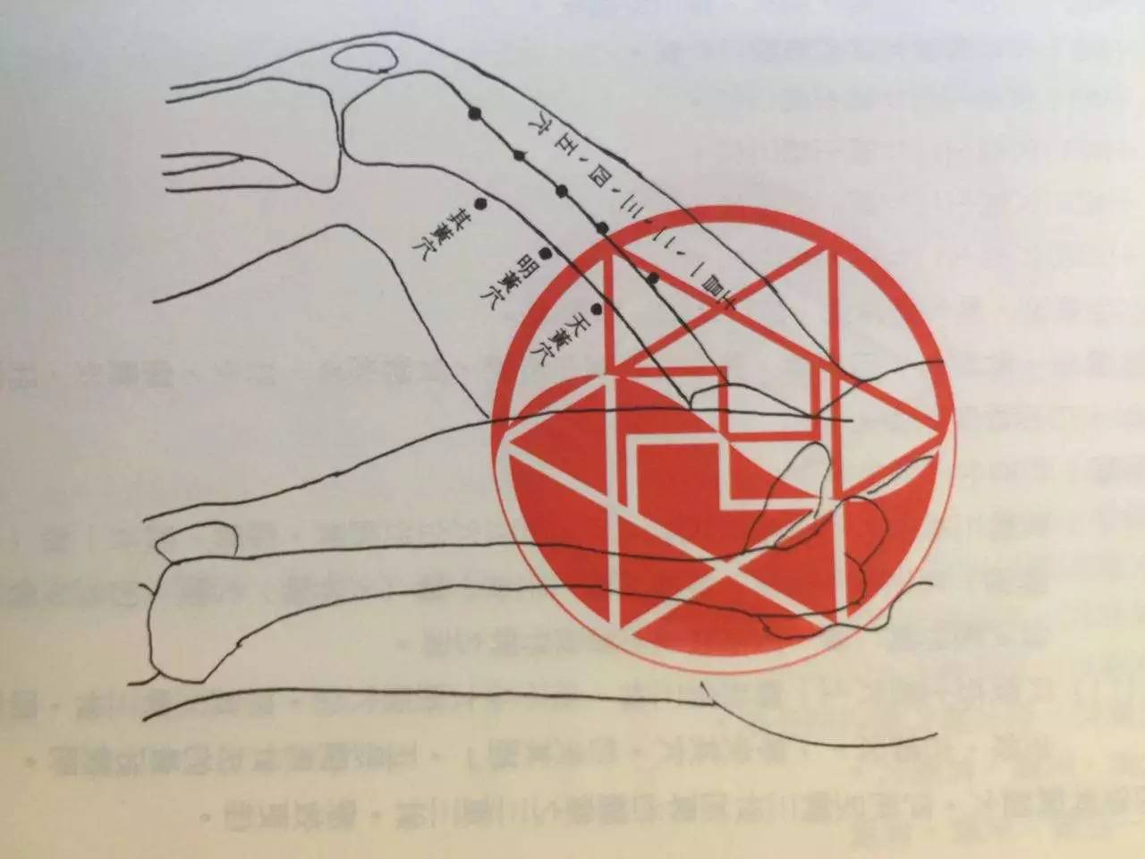 董氏针灸新一期上三黄穴位讲解及病情案例分享