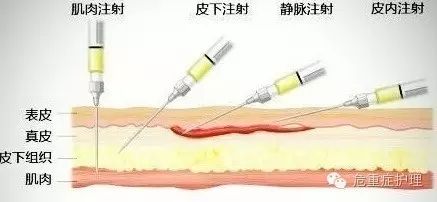 腹部注射肝素钠位置图图片