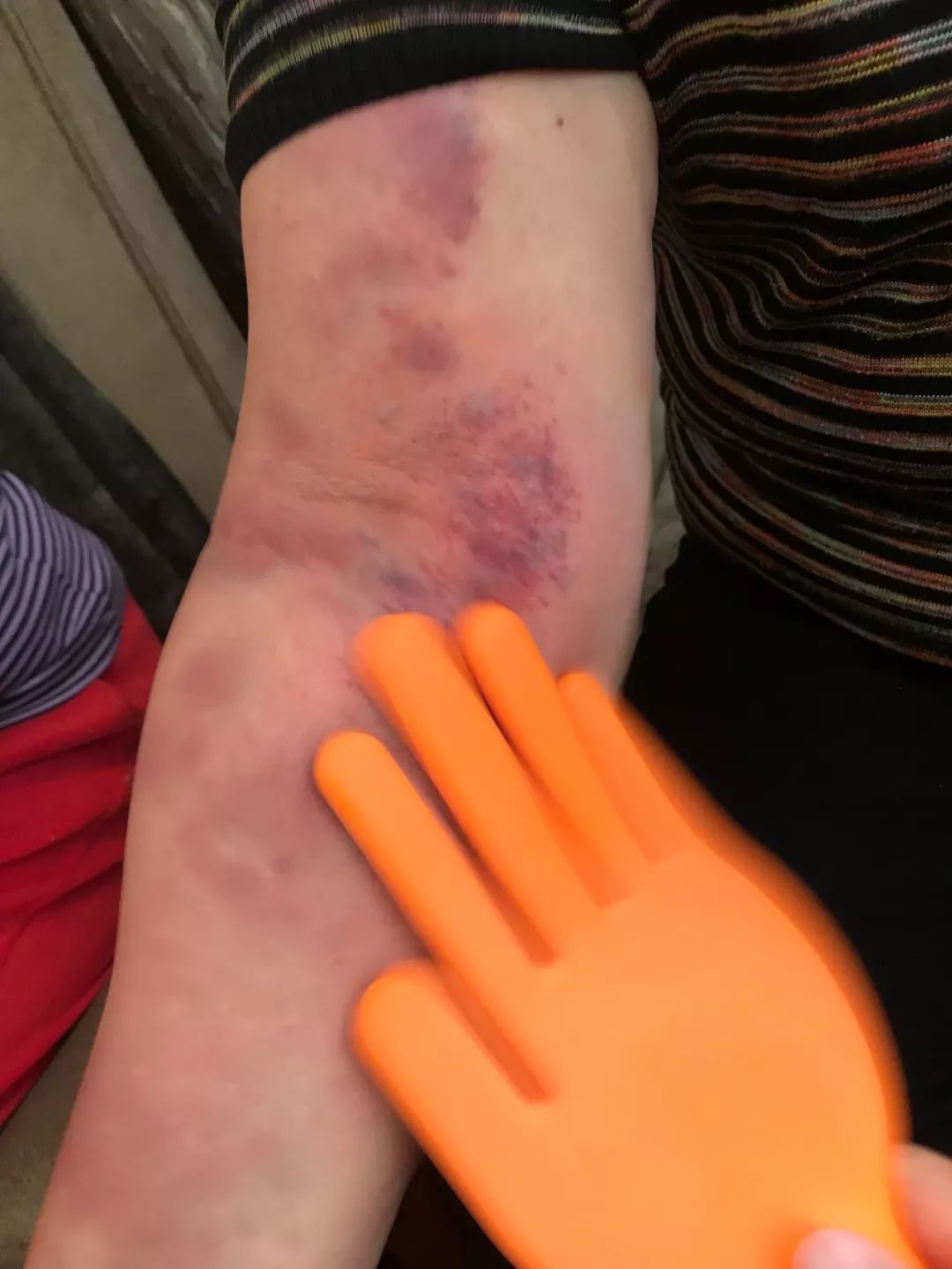 拍打八虚教学视频之一:拍打手臂内侧,肘关节改善心肺功能效果好