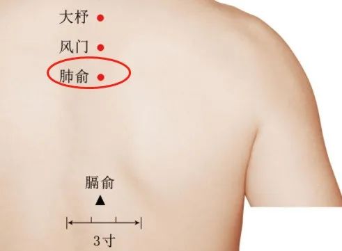 三伏天灸冬病夏治最合宜这六种病症一定要现在调