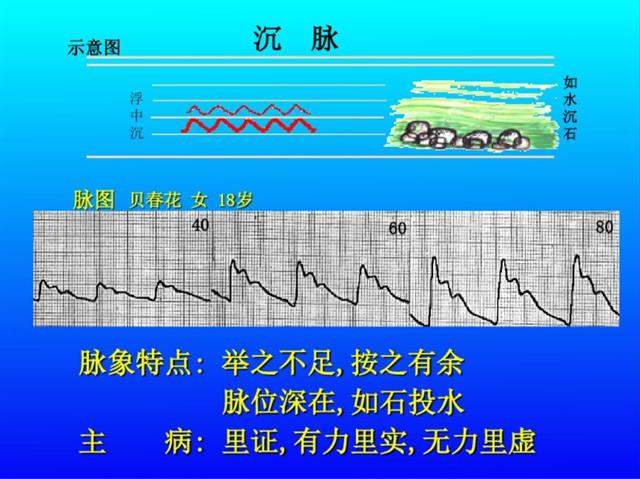 脉诊图解大全28种脉象让你快速掌握脉诊