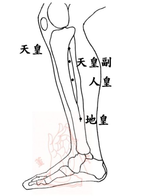 董氏奇穴重子肾关木穴妇科五虎的特效经验