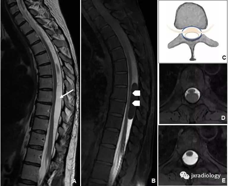 分类进展an update on the diagnosis and classification of cystic