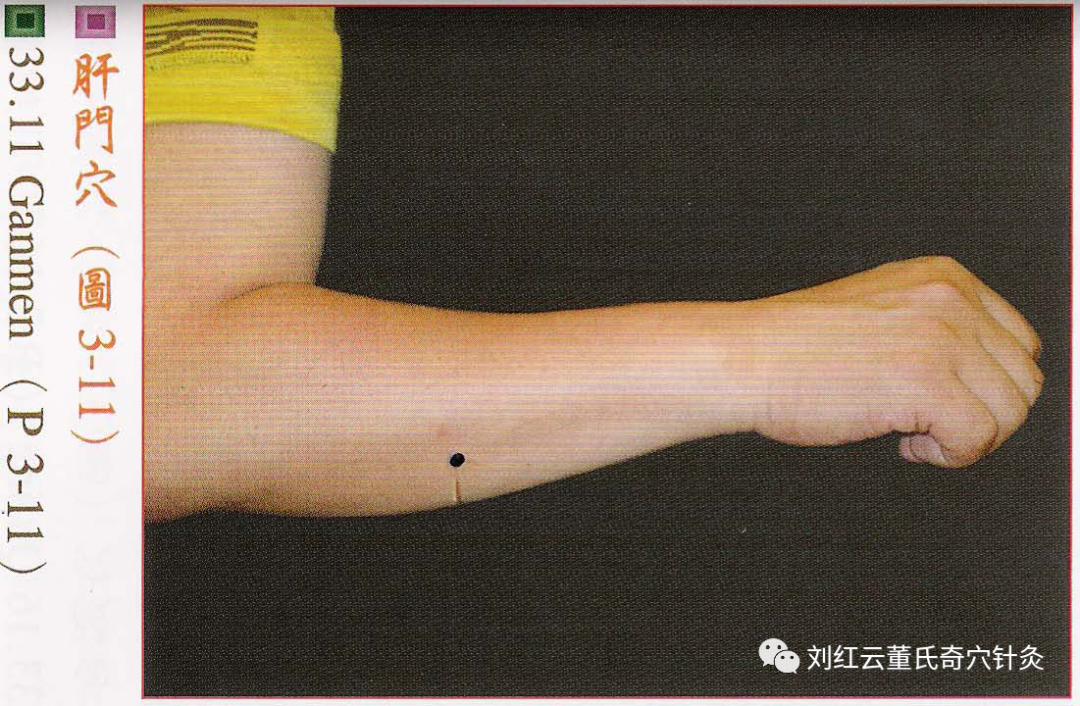 董氏奇穴三三部分前臂部位穴位详解收藏版带高清大图