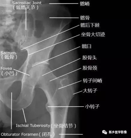 股骨x线解剖图片