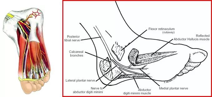 足跟痛的诊断与治疗要点
