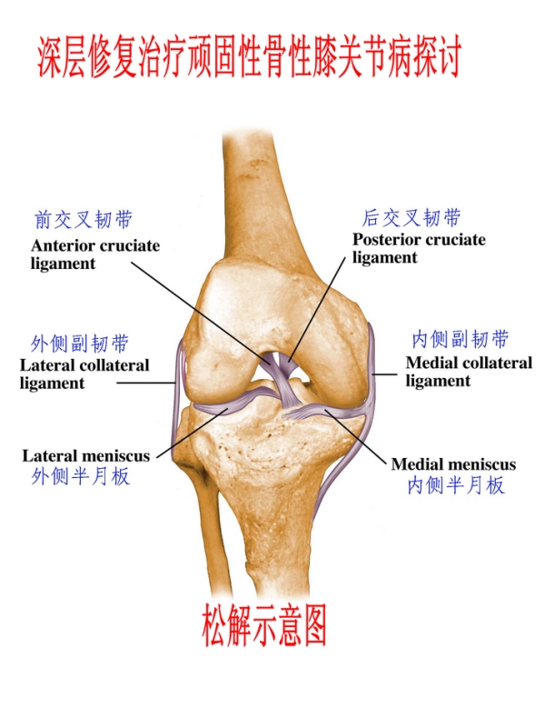 微创第一步:在髌周环形定6个点,针刀切开髌周韧带,目的是打开髌骨下