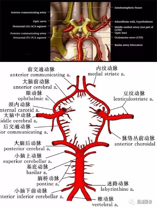 大脑前动脉a1段图解图片