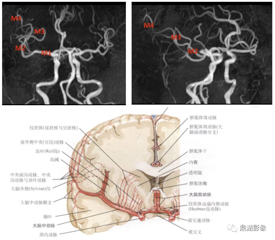 大脑后动脉(pca)1 基底动脉2 后交通动脉3 pca p1 段4 穿支5