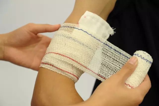 螺旋包扎法4,最后将绷带多余的减掉,用胶布粘贴固定,也可将绷带尾端从