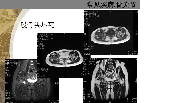 包含安贞医院代取报告核磁(MRI)到底有什么区别?的词条