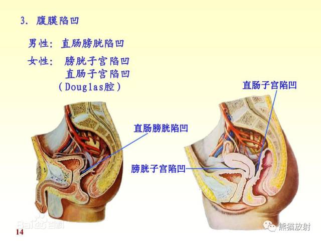 【解剖】腹膜及腹膜腔(经典讲解汇总) 